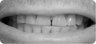 Dental treatment before procedure in Phoenix, AZ